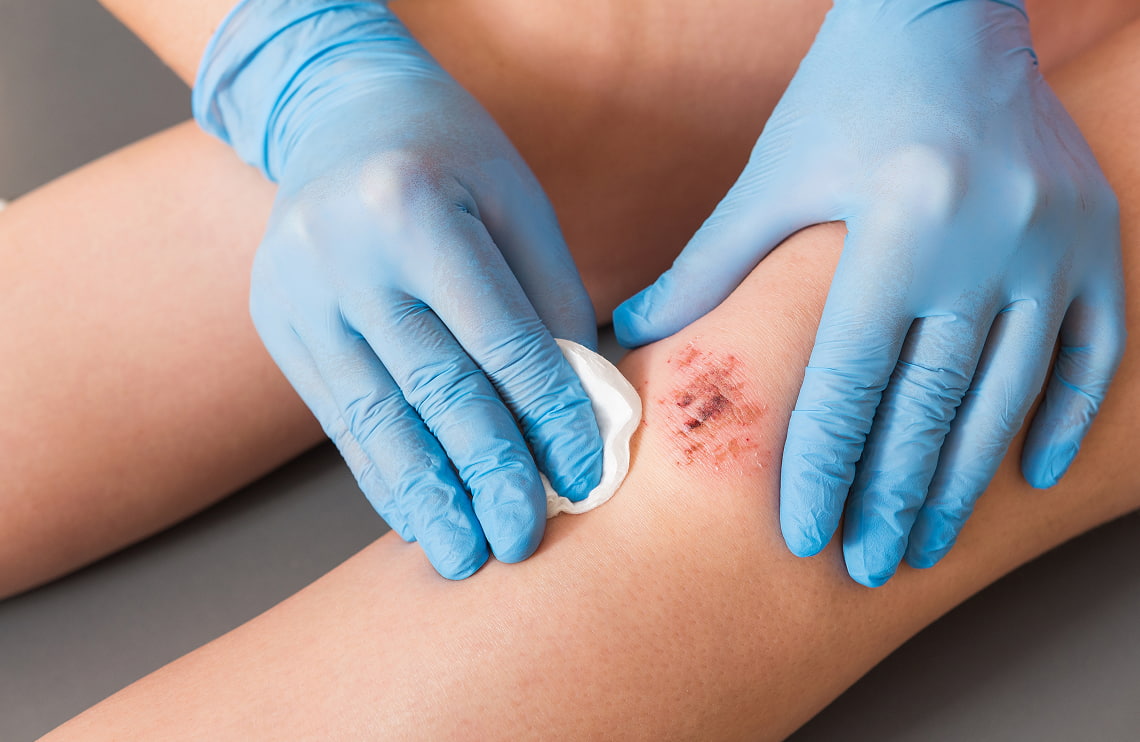 The Do’s & Don’ts of Wound Care You Should Know